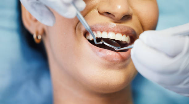 Best Emergency Treatment for Oral Infections in Coeur Dalene, ID